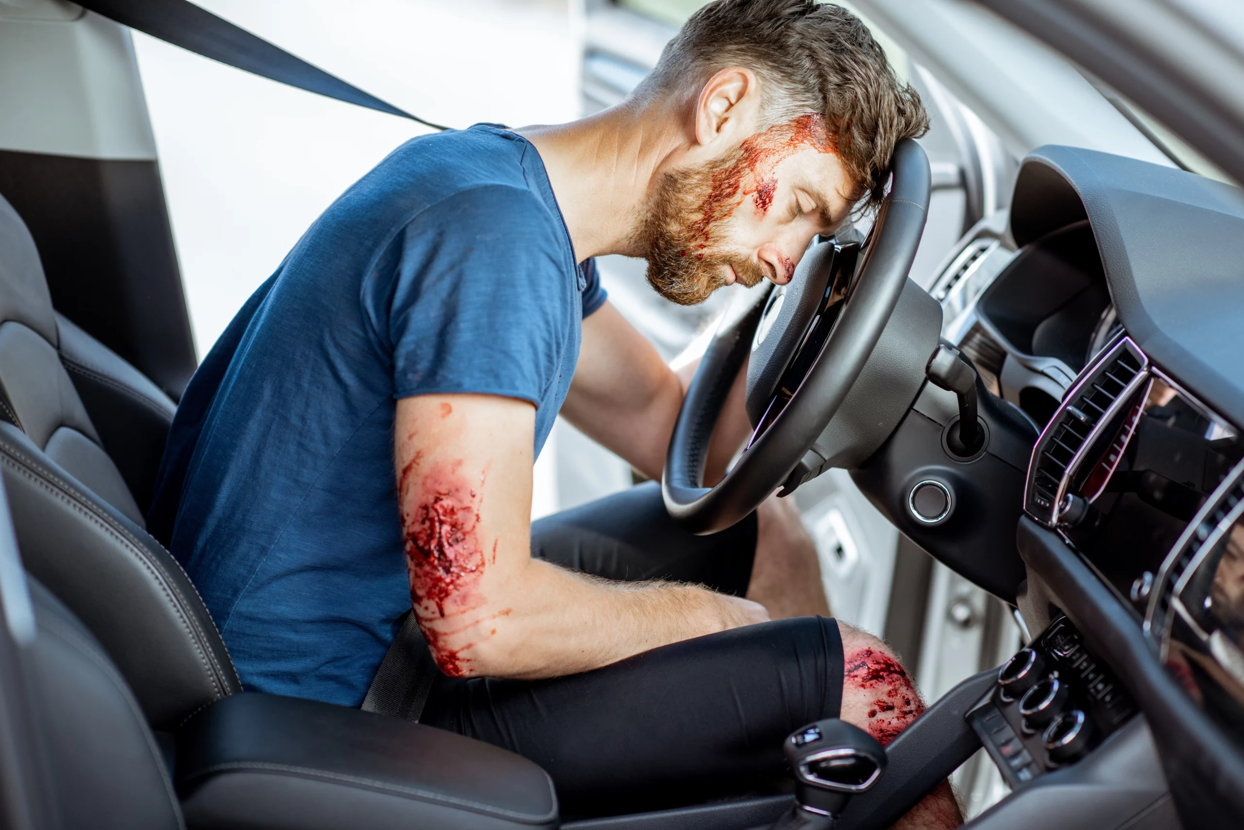 how long after an accident can you sue in California