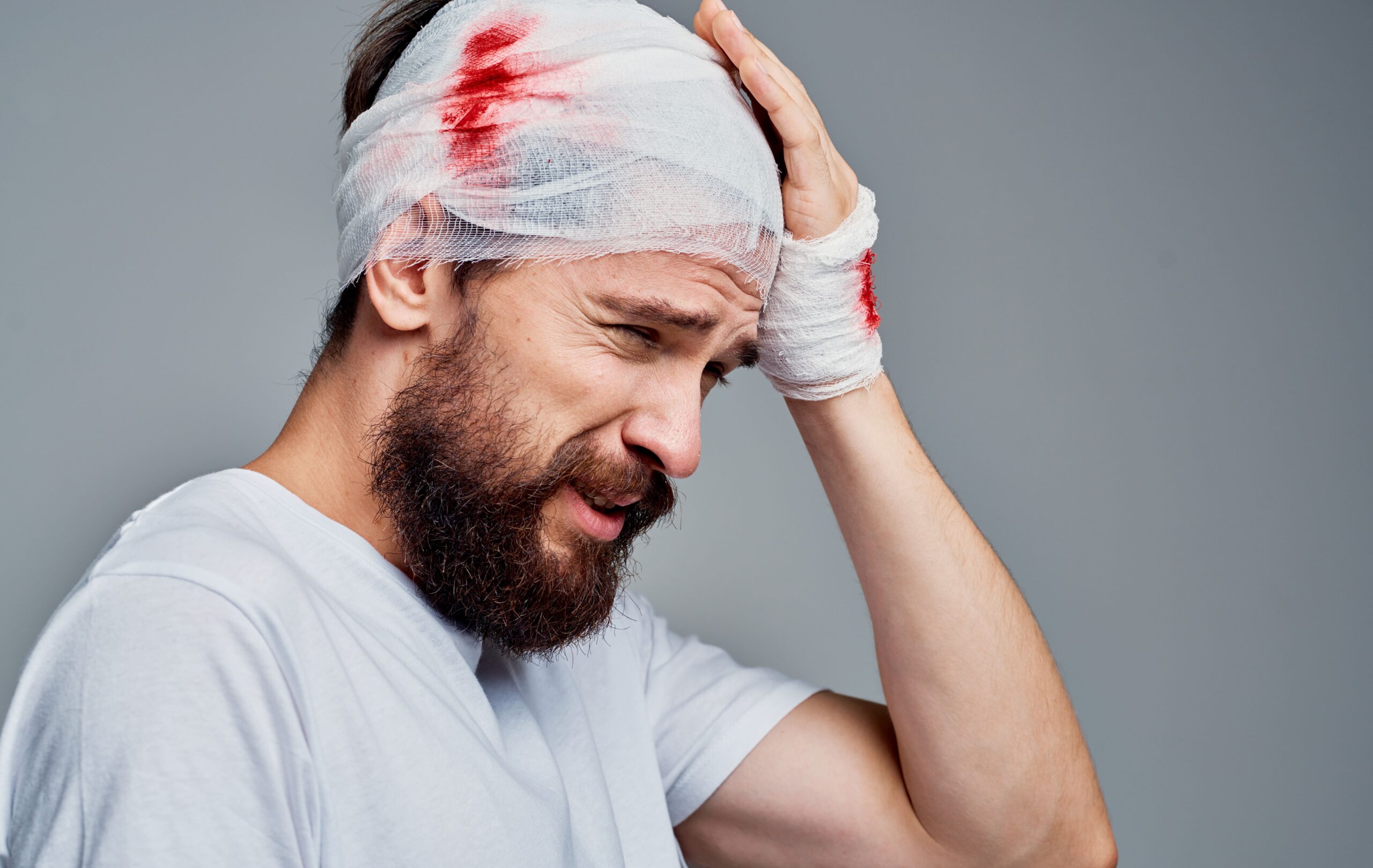 Man with bandaged head showing signs of concussion after a car accident injury.